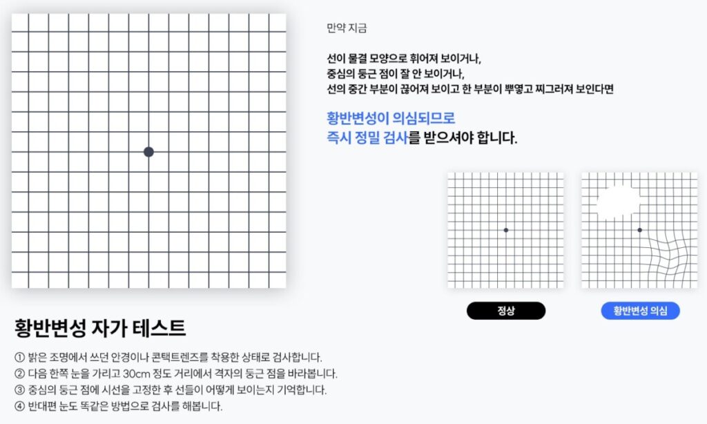 황반변성 자가진단을 위한 암슬러 격자 바둑판 모양판과 중심점 응시 테스트 이미지