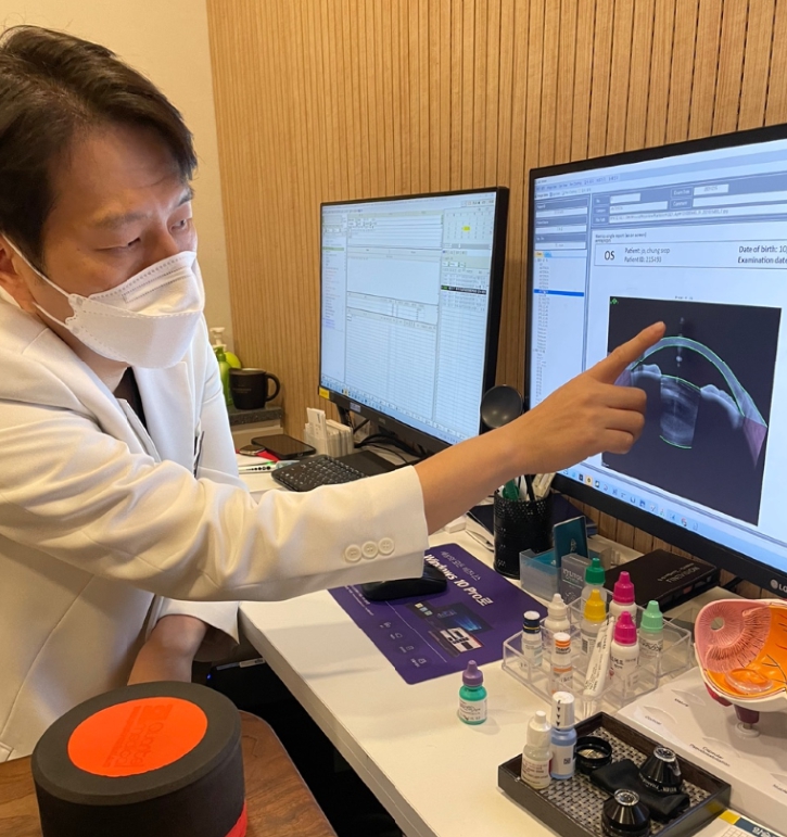 ICL 렌즈 부작용, 렌즈삽입술 후기, 각막 내피 세포, 렌즈삽입술 부작용, 렌즈삽입술 가격