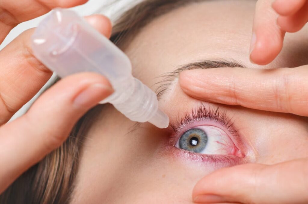 스마일프로 수술 후 빠른 회복과 감염 예방을 위해 안약을 올바른 방법으로 점안하는 모습