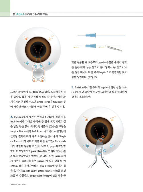 9e4c6ae99ef75151885f6a68c7163f47_1679021011_2896.jpg 9e4c6ae99ef75151885f6a68c7163f47_1679021011_2896.jpg